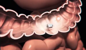 PillCam