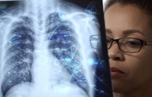 AI radiology